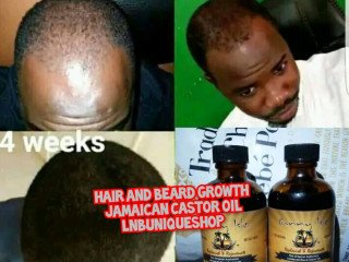 jamaican-castor-oil